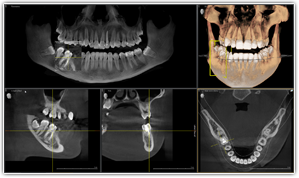 CT検査の必要性
