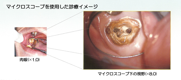 マイクロスコープからの写真